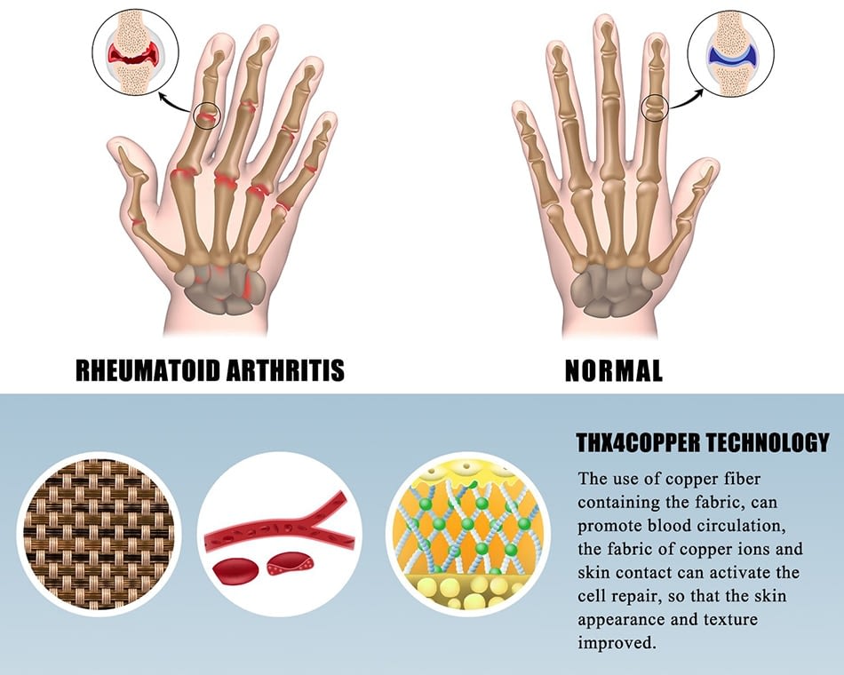Premium Arthritis Compression Gloves Premium Arthritis Compression Gloves